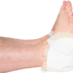 Pressure Relief Heel Protectors